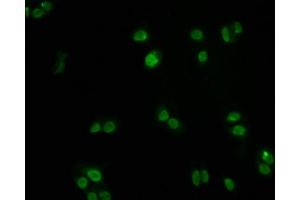 Immunofluorescence staining of PC3 cells with ABIN7127500 at 1:60, counter-stained with DAPI. (Rekombinanter FOXO3 Antikörper)