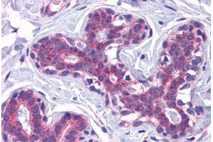 Human Breast: Formalin-Fixed, Paraffin-Embedded (FFPE) (SCAMP4 Antikörper  (C-Term))