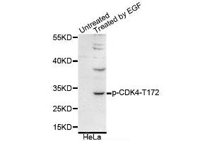 Western blot analysis of extracts of various cell lines, using Phospho-CDK4-T172 antibody (ABIN5995651). (CDK4 Antikörper  (pThr172))