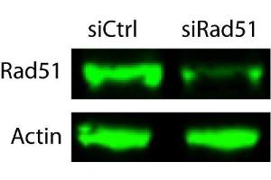 Western blot analysis of Rad51 using anti-Rad51 antibody (ABIN3043560).