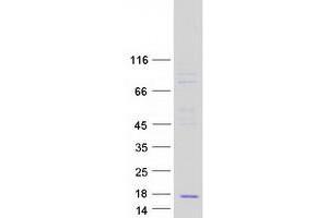 Validation with Western Blot (CCL23 Protein (Myc-DYKDDDDK Tag))