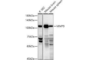 Western blot analysis of extracts of various cell lines, using MMP9 antibody (ABIN3022899, ABIN3022900, ABIN3022901, ABIN1513215 and ABIN6219286) at 1:1000 dilution. (MMP 9 Antikörper  (AA 538-707))
