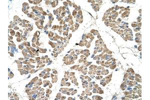 SLC22A7 antibody was used for immunohistochemistry at a concentration of 4-8 ug/ml to stain Skeletal muscle cells (arrows) in Human Muscle.
