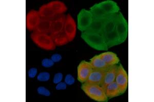 ABIN6262407 and ABIN6276441 staining Hela cells(30 min of UV treatment) by IF/ICC. (GRP94 Antikörper  (C-Term))