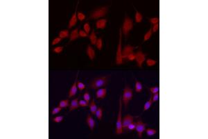 Immunofluorescence (IF) image for anti-Exostosin 1 (EXT1) (AA 467-746) antibody (ABIN3022737)