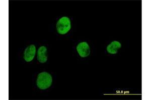 Immunofluorescence of purified MaxPab antibody to RPA2 on HeLa cell.