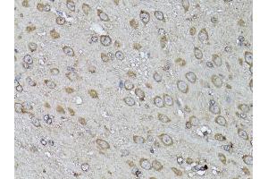 Immunohistochemistry of paraffin-embedded mouse brain using SNAI1 antibody (ABIN5998900) at dilution of 1/100 (40x lens).