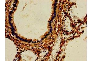 Immunohistochemistry of paraffin-embedded human lung tissue using ABIN7159328 at dilution of 1:100 (AOC3 Antikörper  (AA 27-259))