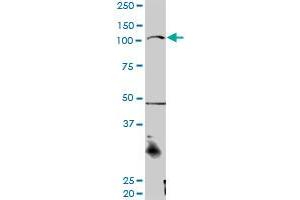CTNNA3 MaxPab rabbit polyclonal antibody. (CTNNA3 Antikörper  (AA 1-516))