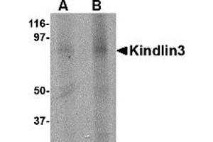 Western Blotting (WB) image for anti-Fermitin Family Member 3 (FERMT3) (C-Term) antibody (ABIN1030468) (FERMT3 Antikörper  (C-Term))