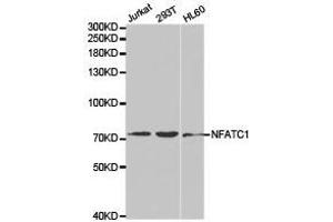 Western Blotting (WB) image for anti-Nuclear Factor of Activated T-Cells, Cytoplasmic, Calcineurin-Dependent 1 (NFATC1) antibody (ABIN1873889) (NFATC1 Antikörper)