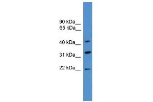 WB Suggested Anti-ARFIP1  Antibody Titration: 0.