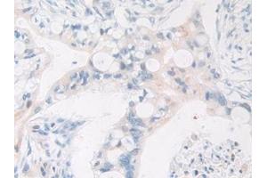 Immunohistochemistry (IHC) image for anti-Farnesyl-Diphosphate Farnesyltransferase 1 (FDFT1) (AA 269-417) antibody (ABIN7433993)