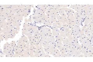 Detection of SSA1 in Mouse Cardiac Muscle Tissue using Polyclonal Antibody to Sjogren Syndrome Antigen A1 (SSA1) (TRIM21 Antikörper  (AA 272-470))
