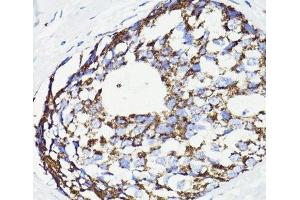 Immunohistochemistry (Paraffin-embedded Sections) (IHC (p)) image for anti-Programmed Cell Death 10 (PDCD10) antibody (ABIN7009630)