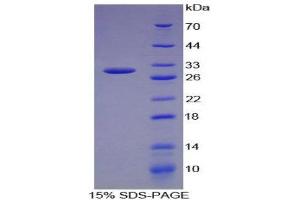 SDS-PAGE (SDS) image for Dopamine beta-Hydroxylase (Dopamine beta-Monooxygenase) (DBH) (AA 335-571) protein (His tag) (ABIN1879382)