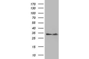 Western Blotting (WB) image for anti-Exosome Component 7 (EXOSC7) antibody (ABIN1498143) (EXOSC7 Antikörper)