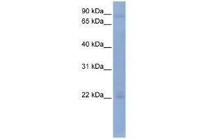 WB Suggested Anti-OAS2 Antibody Titration:  0. (OAS2 Antikörper  (Middle Region))