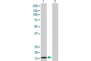 Western Blot analysis of IFNA2 expression in transfected 293T cell line by IFNA2 monoclonal antibody (M38), clone 2D10. (IFNA2 Antikörper  (AA 24-188))