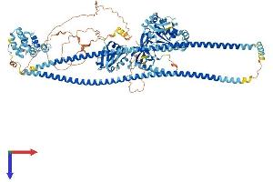 CARD14 Protein (AA 1-1004) (His tag)
