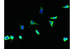 Immunofluorescent analysis of Hela cells using ABIN7153737 at dilution of 1:100 and Alexa Fluor 488-congugated AffiniPure Goat Anti-Rabbit IgG(H+L) (TSTA3 Antikörper  (AA 1-314))