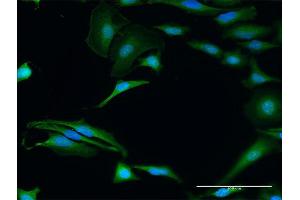 Immunofluorescence of purified MaxPab antibody to FXR2 on HeLa cell. (FXR2 Antikörper  (AA 1-673))