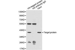 Image no. 1 for anti-His Tag antibody (ABIN2932978) (His Tag Antikörper)