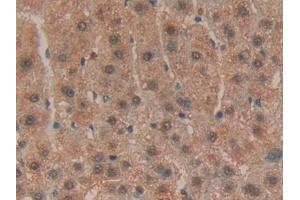 Immunohistochemistry (IHC) image for anti-Hypoxanthine phosphoribosyltransferase 1 (HPRT1) (AA 3-218) antibody (ABIN7432454)