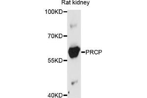 Western blot analysis of extracts of rat kidney, using PRCP antibody (ABIN5972205) at 1/1000 dilution.