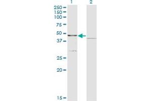 Western Blot analysis of COQ3 expression in transfected 293T cell line by COQ3 monoclonal antibody (M01), clone 6D5. (COQ3 Antikörper  (AA 273-369))