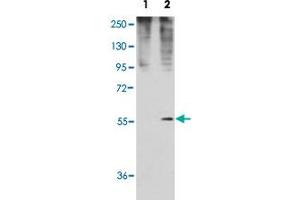 Western blot analysis of GDF11 (arrow) using rabbit GDF11 polyclonal antibody . (GDF11 Antikörper  (N-Term))