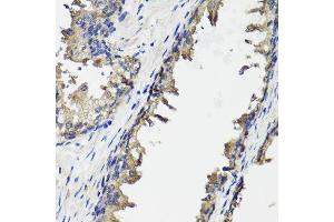 Immunohistochemistry of paraffin-embedded human prostate using OTC antibody (ABIN6003566) at dilution of 1/100 (40x lens). (OTC Antikörper)