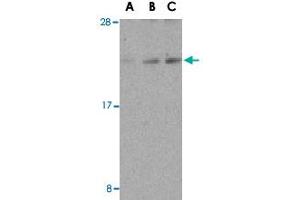 Western blot analysis of DAD1 in HepG2 cell lysate with DAD1 polyclonal antibody  at (A) 0. (DAD1 Antikörper  (C-Term))