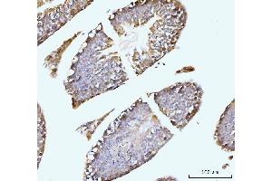 IHC analysis of GIT1 using anti-GIT1 antibody (ABIN7601683). (GIT1 Antikörper  (AA 415-736))