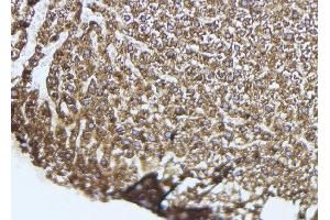 ABIN6274051 at 1/100 staining Mouse liver tissue by IHC-P.