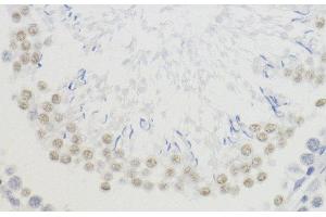 Immunohistochemistry (Paraffin-embedded Sections) (IHC (p)) image for anti-Histone H4 (3meLys20) antibody (ABIN7260402)