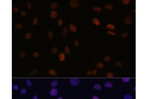 Immunofluorescence analysis of C6 cells using PSME3 Polyclonal Antibody at dilution of 1:100 (40x lens). (PSME3 Antikörper)