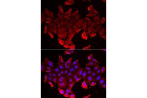 Immunofluorescence analysis of HeLa cell using SLC23A2 antibody. (SLC23A2 Antikörper)
