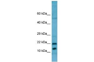 WB Suggested Anti-RPL11 AntibodyTitration: 1.