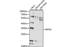 Western blot analysis of extracts of various cell lines, using RFPL4 antibody (ABIN7269924) at 1:1000 dilution.