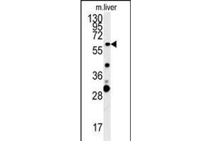 ZCCHC5 Antibody (N-term) (ABIN654002 and ABIN2843937) western blot analysis in mouse liver tissue lysates (15 μg/lane).
