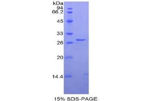 SDS-PAGE (SDS) image for Elastase 3B, Pancreatic (ELA3B) (AA 29-270) protein (His tag) (ABIN1878497)
