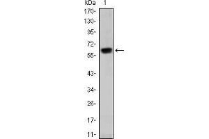 Western blot analysis using OTX2 mAb against human OTX2 (AA: 40-297) recombinant protein. (OTX2 Antikörper)