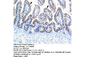 Human Intestine (TRIM15 Antikörper  (N-Term))