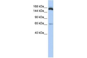 WB Suggested Anti-KIAA0460 Antibody Titration: 0. (RPRD2 Antikörper  (Middle Region))