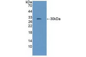 Detection of Recombinant NOS1AP, Mouse using Polyclonal Antibody to Nitric Oxide Synthase 1 Adaptor Protein (NOS1AP)