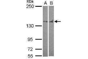 PTPN14 Antikörper  (C-Term)