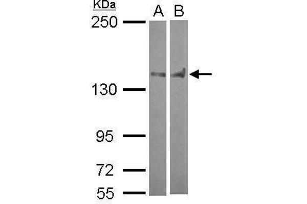 PTPN14 Antikörper  (C-Term)