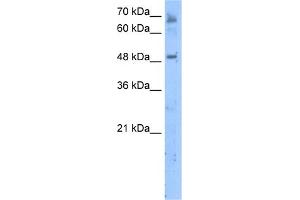 WB Suggested Anti-LENG4 Antibody Titration:  5.