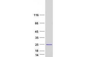Western Blotting (WB) image for Cofilin 2 (CFL2) (Transcript Variant 1) protein (Myc-DYKDDDDK Tag) (ABIN2712945)